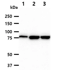 WB analysis of various samples using GTX57715 MCM7 antibody. Lane 1 : HeLa whole cell lysate Lane 2 : Jurkat whole cell lysate Lane 3 : K562 whole cell lysate Loading : 40 microg Dilution : 1:1000 WB analysis of various samples using GTX57715 MCM7 antibody. Lane 1 : HeLa whole cell lysate Lane 2 : Jurkat whole cell lysate Lane 3 : K562 whole cell lysate Loading : 40 microg Dilution : 1:1000
