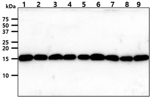 WB analysis of various samples using GTX57716 TOMM20 antibody. Lane 1 : HeLa whole cell lysate Lane 2 : HepG2 whole cell lysate Lane 3 : A431 whole cell lysate Lane 4 : K562 whole cell lysate Lane 5 : A549 whole cell lysate Lane 6 : 293T whole cell lysate Lane 7 : MCF-7 whole cell lysate Lane 8 : SK-OV-3 whole cell lysate Lane 9 : PC-3 whole cell lysate Loading : 40 microg Dilution : 1:1000