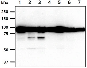 WB analysis of various samples using GTX57717 Calnexin antibody. Lane 1 : HeLa whole cell lysate Lane 2 : MCF-7 whole cell lysate Lane 3 : A431 whole cell lysate Lane 4 : A549 whole cell lysate Lane 5 : 293T whole cell lysate Lane 6 : HepG2 whole cell lysate Lane 7 : Jurkat whole cell lysate Loading : 40 microg Dilution : 1:1000