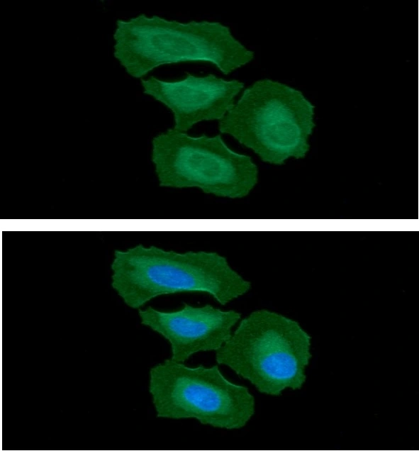 ICC/IF analysis of HeLa cells using GTX57718 Integrin beta 1 / CD29 antibody. Blue: DAPI Green: Primary antibody Dilution: 1:100 ICC/IF analysis of HeLa cells using GTX57718 Integrin beta 1 / CD29 antibody. Blue: DAPI Green: Primary antibody Dilution: 1:100