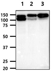 WB analysis of various samples using GTX57718 Integrin beta 1 / CD29 antibody. Lane 1 : A549 whole cell lysate Lane 2 : PC-3 whole cell lysate Lane 3 : HT1080 whole cell lysate Loading : 40 microg Dilution : 1:1000