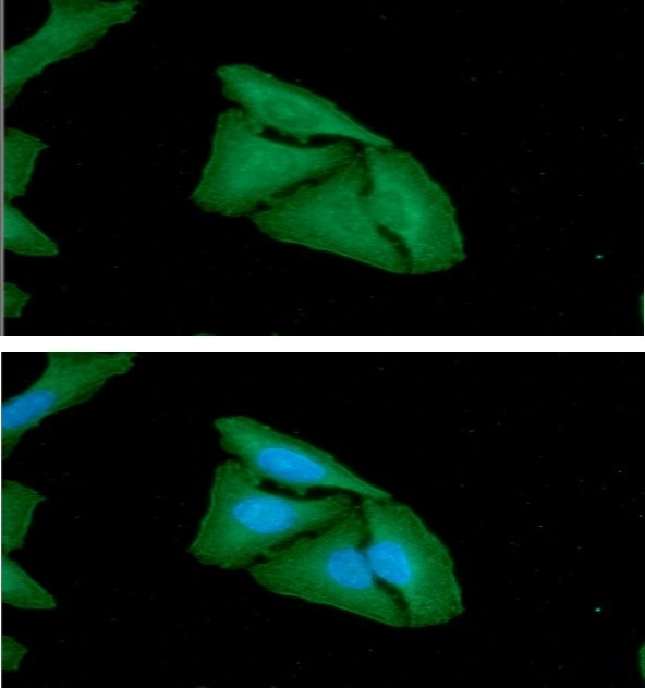ICC/IF analysis of HeLa cells using GTX57719 FHL2 antibody. Blue: DAPI Green: Primary antibody Dilution: 1:100 ICC/IF analysis of HeLa cells using GTX57719 FHL2 antibody. Blue: DAPI Green: Primary antibody Dilution: 1:100