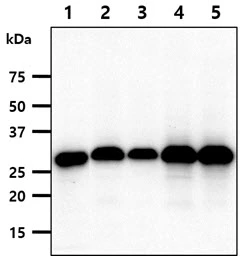 WB analysis of various samples using GTX57719 FHL2 antibody. Lane 1 : HeLa whole cell lysate Lane 2 : A549 whole cell lysate Lane 3 : MCF-7 whole cell lysate Lane 4 : SK-OV-3 whole cell lysate Lane 5 : HT1080 whole cell lysate Loading : 40 microg Dilution : 1:1000