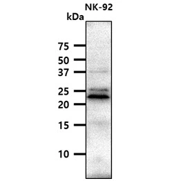 WB analysis of NK-92 whole cell lysate using GTX57720 CD94 antibody. Loading : 40 microg Dilution : 1:1000