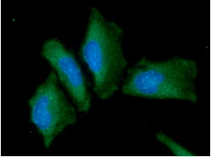 ICC/IF analysis of HeLa cells using GTX57721 Alpha fetoprotein / AFP antibody. Blue: DAPI Green: Primary antibody Dilution: 1:100