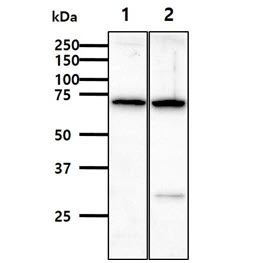 WB analysis of various samples using GTX57721 Alpha fetoprotein / AFP antibody. Lane 1 : Jurkat whole cell lysate Lane 2 : Raw264.7 whole cell lysate Loading : 40 microg Dilution : 1:1000