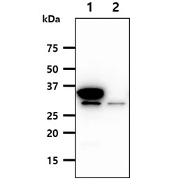 WB analysis of various samples using GTX57723 SULT2A1 antibody. Lane 1 : SULT2A1 transfected 293T cell lysate Lane 2 : 293T cell lysate Loading : 40 microg Dilution : 1:1000