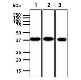 WB analysis of various samples using GTX57724 ATG3 antibody. Lane 1 : K562 whole cell lysate Lane 2 : Raji whole cell lysate Lane 3 : Jurkat whole cell lysate Loading : 40 microg Dilution : 1:1000