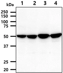 WB analysis of various samples using GTX57725 PDHX antibody. Lane 1 : A431 whole cell lysate Lane 2 : HepG2 whole cell lysate Lane 3 : 293T whole cell lysate Lane 4 : LNCap whole cell lysate Loading : 40 microg Dilution : 1:1000 WB analysis of various samples using GTX57725 PDHX antibody. Lane 1 : A431 whole cell lysate Lane 2 : HepG2 whole cell lysate Lane 3 : 293T whole cell lysate Lane 4 : LNCap whole cell lysate Loading : 40 microg Dilution : 1:1000
