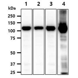 WB analysis of various samples using GTX57726 Hexokinase I + Hexokinase II + Hexokinase III antibody [AT4C12]. Lane 1 : HeLa whole cell lysate Lane 2 : Jurkat whole cell lysate Lane 3 : K562 whole cell lysate Lane 4 : Mouse brain tissue lysate Loading : 40 microg Dilution : 1:1000