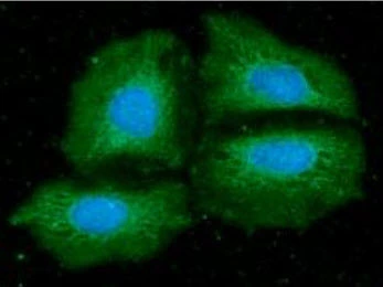 ICC/IF analysis of HeLa cells using GTX57729 NMT1 antibody. Blue: DAPI Green: Primary antibody Dilution: 1:100