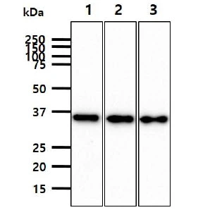 WB analysis of various samples using GTX57731 JAM-B antibody. Lane 1 : K562 whole cell lysate Lane 2 : LNCap whole cell lysate Lane 3 : A549 whole cell lysate Loading : 40 microg Dilution : 1:1000