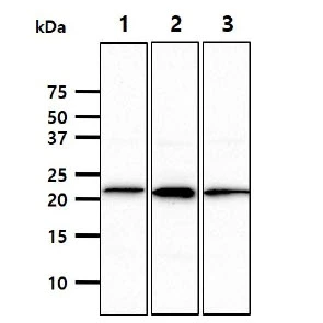 WB analysis of various samples using GTX57732 NCR3 antibody. Lane 1 : THP-1 whole cell lysate Lane 2 : Ramos whole cell lysate Lane 3 : TF-1 whole cell lysate Loading : 40 microg Dilution : 1:1000 WB analysis of various samples using GTX57732 NCR3 antibody. Lane 1 : THP-1 whole cell lysate Lane 2 : Ramos whole cell lysate Lane 3 : TF-1 whole cell lysate Loading : 40 microg Dilution : 1:1000
