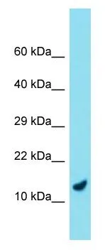 WB analysis of human placenta lysate using GTX57735 C9orf116 antibody. Dilution : 1 microg/ml WB analysis of human placenta lysate using GTX57735 C9orf116 antibody. Dilution : 1 microg/ml