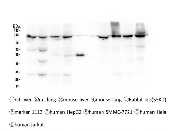 WB analysis of various samples using GTX57736 CRM1 antibody [5G3]. Lane 1 : rat liver tissue lysate Lane 2 : rat lung tissue lysate Lane 3 : mouse liver tissue lysate Lane 4 : mouse lung tissue lysate Lane 5 : Rabbit IgG Lane 6 : Marker Lane 7 : HepG2 whole cell lysate Lane 8 : SMMC-7721 whole cell lysate Lane 9 : HeLa whole cell lysate Lane 10 :Jukat whole cell lysate Dilution : 0.5microg/ml Loading : 50microg per lane