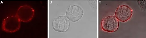Live cell imaging analysis of MCF-7 cells using GTX57738 EphA1 antibody. Panel A : Primary antibody Panel B : Live view of the cells Panel C : Merged of panel A and B Dilution : 1:25