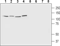 WB analysis of Jurkat (Lanes 1 and 5), HeLa (Lanes 2 and 6), SH-SY5Y (Lanes 3 and 7), and MCF-7 (Lanes 4 and 8) cell lysates using GTX57738 EphA1 antibody. Lane 1-4 : Primary antibody Lane 5-8 : Primary antibody preincubated with the control peptide antigen Dilution : 1:200