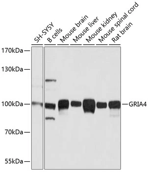 WB analysis of various sample lysates using GTX57744 GluR4 antibody. Dilution : 1:1000 Loading : 25microg per lane WB analysis of various sample lysates using GTX57744 GluR4 antibody. Dilution : 1:1000 Loading : 25microg per lane