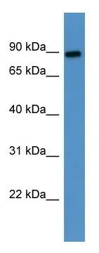 WB analysis of human placenta lysate using GTX57750 LOXL3 antibody. Dilution : 0.2-1 microg/ml