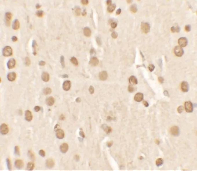 IHC-P analysis of rat brain tissue using GTX57755 NUCB2 antibody. Dilution : 2.5 microg/ml