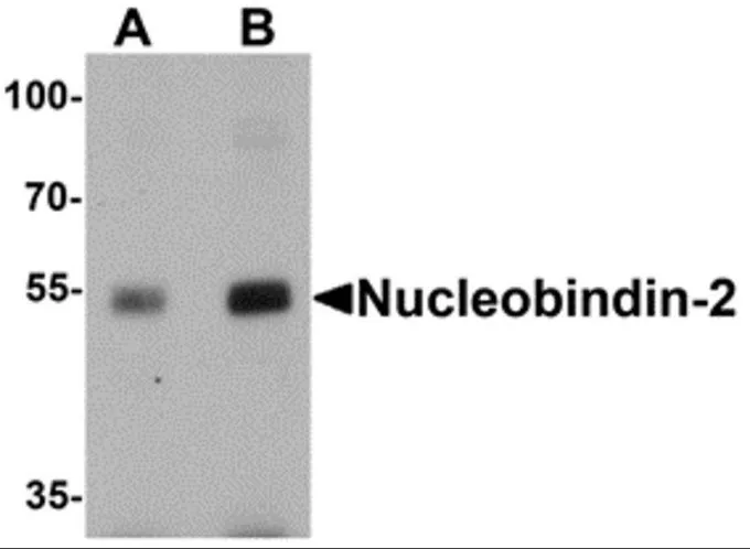 WB analysis of rat brain tissue lysate using GTX57755 NUCB2 antibody. Dilution : 0.5microg/ml (Lane A) and 1microg/ml (Lane B)