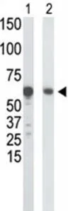 WB analysis of HepG2 cell lysate (Lane 1) and mouse liver tissue lysate (Lane 2) using GTX59598 Glucokinase antibody, N-term. WB analysis of HepG2 cell lysate (Lane 1) and mouse liver tissue lysate (Lane 2) using GTX59598 Glucokinase antibody, N-term.