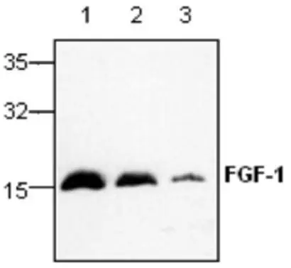 WB analysis of recombinant human FGF-1 protein using GTX59831 FGF1 antibody. Lane1 : 1microg Lane 2 : 250 ng Lane 3 : 50 ng WB analysis of recombinant human FGF-1 protein using GTX59831 FGF1 antibody. Lane1 : 1microg Lane 2 : 250 ng Lane 3 : 50 ng