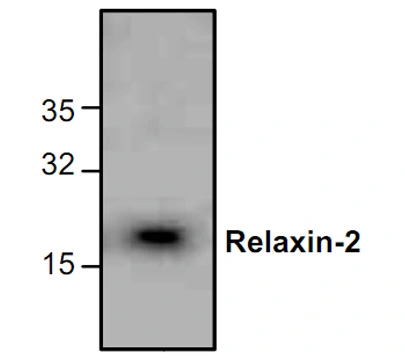 WB analysis of Jurkat cell lysate using GTX59859 Relaxin 2 antibody. WB analysis of Jurkat cell lysate using GTX59859 Relaxin 2 antibody.