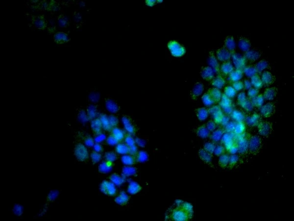 ICC/IF analysis of A431 cells using GTX60131 Cyclin D2 antibody. Green : Primary antibody Blue : DAPI Dilution : 1:200