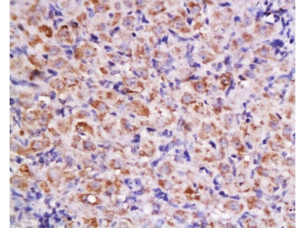 IHC-P analysis of rat ovary tissue using GTX60131 Cyclin D2 antibody. Dilution : 1:200