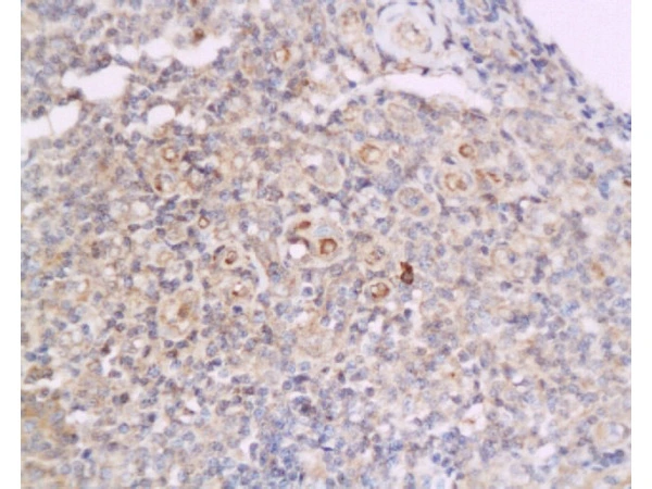 IHC-P analysis of human flat moss tinea tissue using GTX60131 Cyclin D2 antibody. Dilution : 1:200