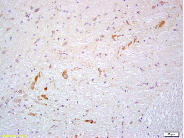 IHC-P analysis of rat brain tissue using GTX60189 Prokineticin 2 antibody. Dilution : 1:200 IHC-P analysis of rat brain tissue using GTX60189 Prokineticin 2 antibody. Dilution : 1:200