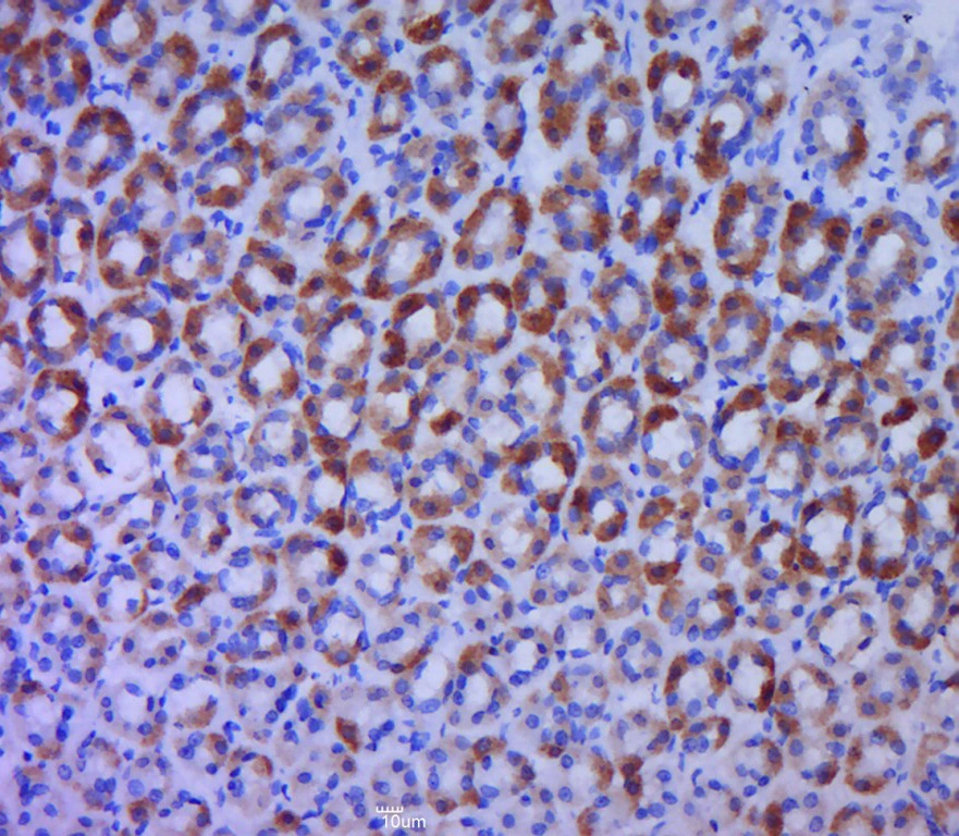 IHC-P analysis of rat stomach tissue using GTX60192 BTG1 antibody. Antigen retrieval : Boiling in sodium citrate buffer (pH6) for 15min Dilution : 1:400