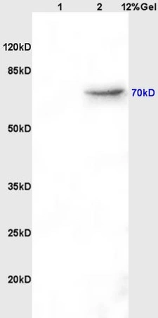 WB analysis of various samples using GTX60214 Alpha fetoprotein / AFP antibody [A2]. Dilution : 1:200 Lane 1 : rat brain lysates Lane 2 : rat kidney lysates