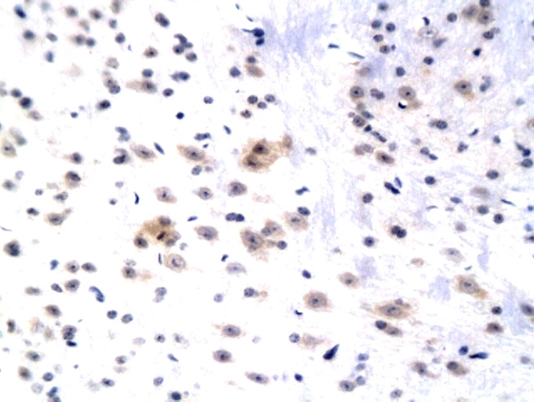 IHC-P analysis of rat hippocampus tissue using GTX60226 WIF1 antibody. IHC-P analysis of rat hippocampus tissue using GTX60226 WIF1 antibody.
