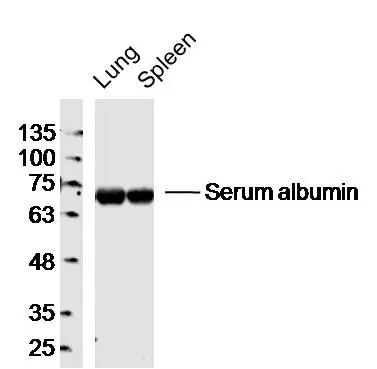 WB analysis of various samples using GTX60252 Albumin antibody [3F4]. Dilution : 1:300 Lane 1 : mouse lung lysates Lane 2 : mouse spleen lysates