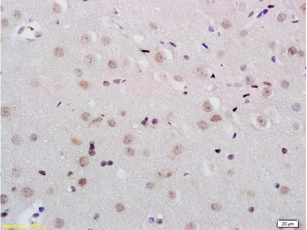 IHC-P analysis of rat brain tissue using GTX60284 KDM5B antibody. Dilution : 1:200 IHC-P analysis of rat brain tissue using GTX60284 KDM5B antibody. Dilution : 1:200