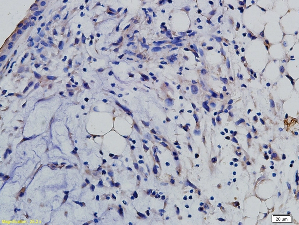 IHC-P analysis of mouse renal tubular endothelial tissue using GTX60322 SLAMF6 antibody. IHC-P analysis of mouse renal tubular endothelial tissue using GTX60322 SLAMF6 antibody.