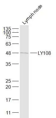 WB analysis of mouse lymph node tissue lysate using GTX60322 SLAMF6 antibody. Dilution : 1:1000