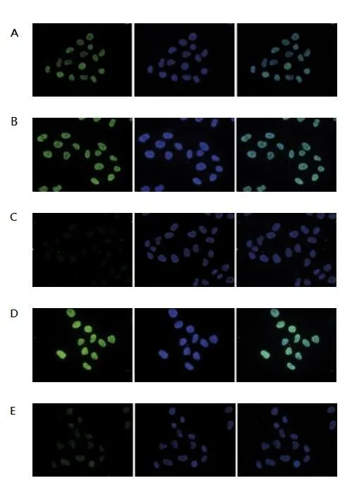 ICC/IF analysis of 4% paraformaldehyde fixed HeLa cells using GTX60337 Histone H4K5K8K12ac (acetyl Lys5/Lys8/Lys12) antibody - ChIP grade. Staining of the cells with the H4K5,8,12ac antibody after incubation of the antibody with 10 ng/microl of the following blocking peptides: H4K5,8,12 unmodified (figure B), H4K5,8,12ac (figure C), H2A.ZK5,7,11ac (figure D) and H4K5,8,12,16ac (figure E). Green : Primary antibody Blue : DAPI Dilution : 1:500