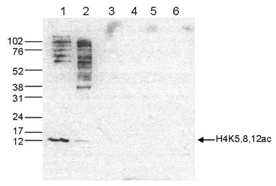 WB analysis of whole cell (25 microg, lane 1) and histone extracts (15 microg, lane 2) from HeLa cells, and on 1 microg of recombinant histone H2A, H2B, H3 and H4 (lane 3, 4, 5 and 6, respectively) using GTX60337 Histone H4K5K8K12ac (acetyl Lys5/Lys8/Lys12) antibody - ChIP grade. Dilution : 1:1,000
