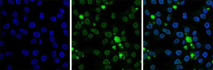 ICC/IF analysis of 4% paraformaldehyde fixed HeLa cells using GTX60346 Histone H2B antibody - ChIP grade. Green : Primary antibody Blue : DAPI Dilution : 1:1000