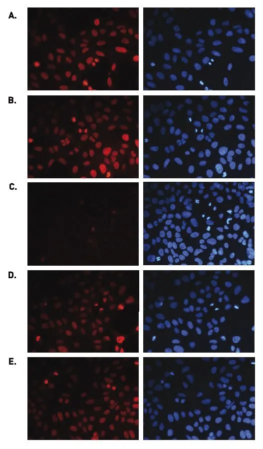 ICC/IF analysis of 4% paraformaldehyde fixed U2OS cells using GTX60354 Histone H3K36me1 (Mono-methyl Lys36) antibody - ChIP grade. Staining of the cells with the H3K36me1 antibody after incubation of the antibody with 2 ng/microl blocking peptide containing the unmodified and the mono-, di- and trimethylated H3K36 (Figure B, C, D, respectively). Red : Primary antibody Blue : DAPI Dilution : 1:500