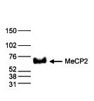 WB analysis of nuclear extracts (25 microg) from HeLa cells using GTX60358 MECP2 antibody - ChIP grade. Dilution : 1:1,000