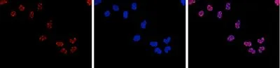 ICC/IF analysis of 4% paraformaldehyde fixed HeLa cells using GTX60366 HDAC3 antibody [GT9007]. Red : Primary antibody Blue : DAPI Dilution : 1:500