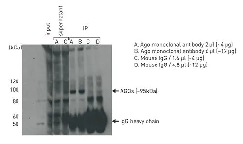 IP analysis of HeLa cells (UV crosslinked and lysaed, and the the lysate was treated with DNase I) using GTX60370 Argonautes antibody [GT9003]. 10 microl of input (10% of starting material), 10 microl of supernatants after immunoprecipitation (10%), and all of immunoprecipitants (~90%) were loaded. Antibody amount : 4 or 12microg.