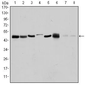 ELISA analysis of antigen using GTX60392 Aurora A antibody [4G10]. Red : Control antigen 100ng Purple : Antigen 10ng Green : Antigen 50ng Blue : Antigen 100ng