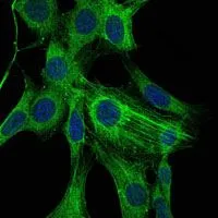 ICC/IF analysis of NIH3T3 cells using GTX60393 alpha Smooth Muscle Actin antibody [1H8]. Green : alpha Smooth Muscle Actin Blue: DRAQ5 fluorescent DNA dye
