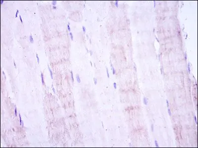 IHC-P analysis of human muscle tissue using GTX60399 SEK1 / MKK4 antibody [5H4].