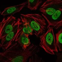 ICC/IF analysis of HeLa cells using GTX60401 DNA-PKcs antibody [3H6]. Green : DNA-PKcs Red: Actin filaments